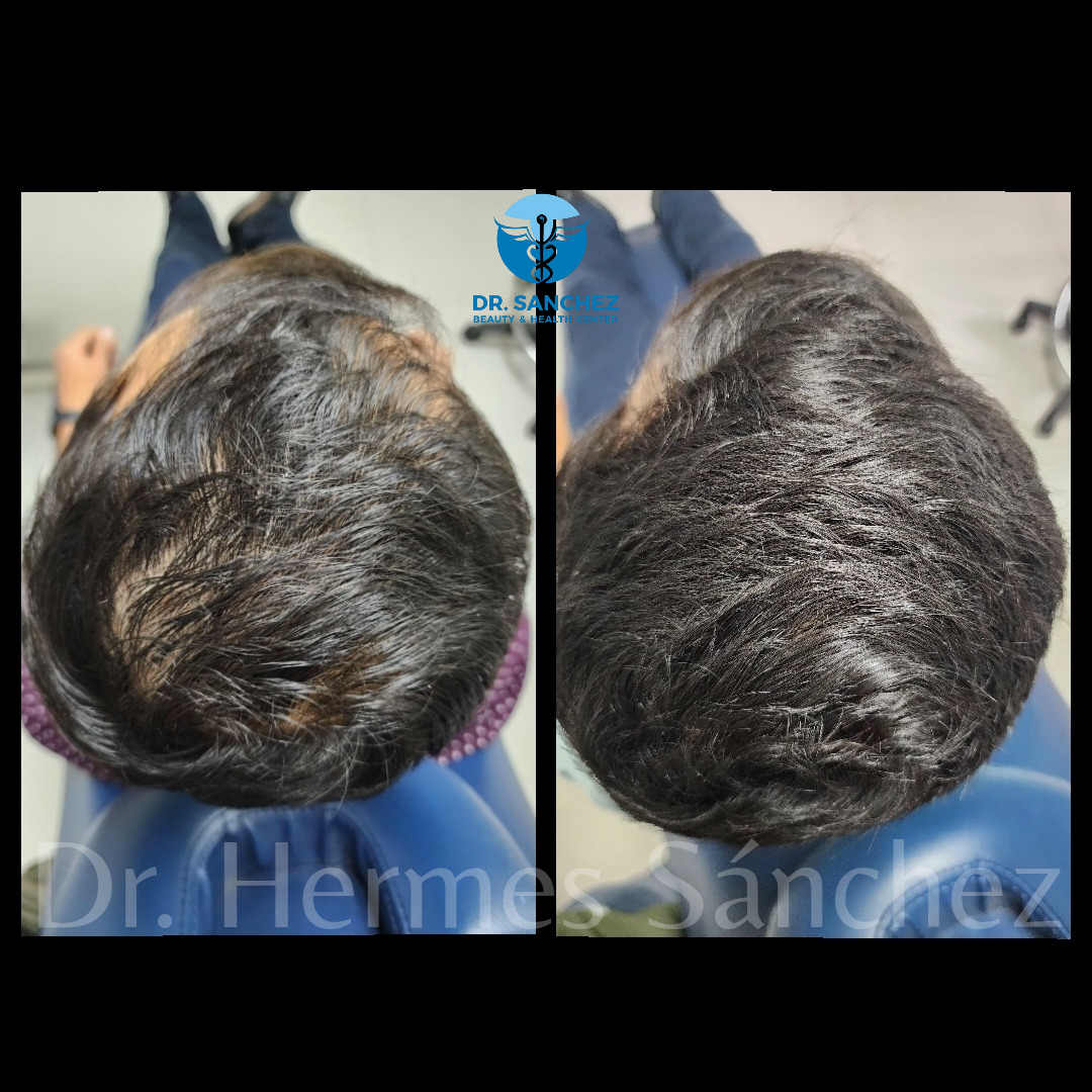 Galería - Transformación 4